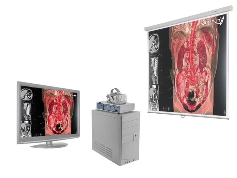 Комплекс Зарница анатомический атлас 4.0/3